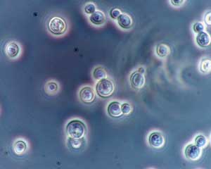 Saccharomyces-cerevisiae